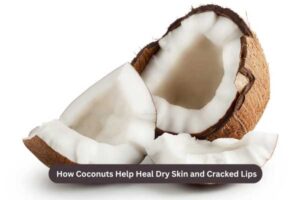 How Coconuts Help Heal Dry Skin and Cracked Lips